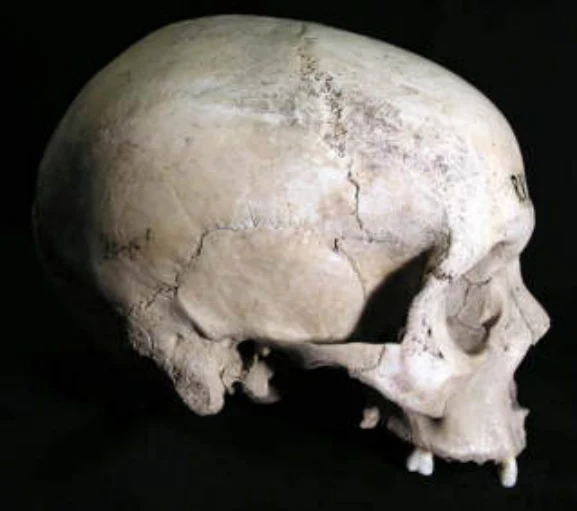 Anthropologische Untersuchung der Schädel aus Qohayto/Eritrea — illustration 4, PDF page 18